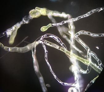 Physcomitrella patens DF (Protonema).jpg