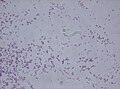 Rhodococcus fascians.jpg