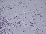 Thumbnail for Rhodococcus fascians