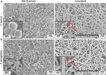 Scanning electron micrograph of electrospun bicomponent nanofibrous mesh incorporating poly(hexamethylene biguanide) and 5-chloro-8-quinolinol. The SEM micrograph presents the bactericidal effect of bicomponent nanofibers incorporating a dual drug-eluting antimicrobial system against S. aureus and P. aeruginosa. Scanning electron microscopy micrograph of electrospun bicomponent nanofibrous mesh incorporating poly(hexamethylene biguanide) and 5-chloro-8-quinolinol..webp