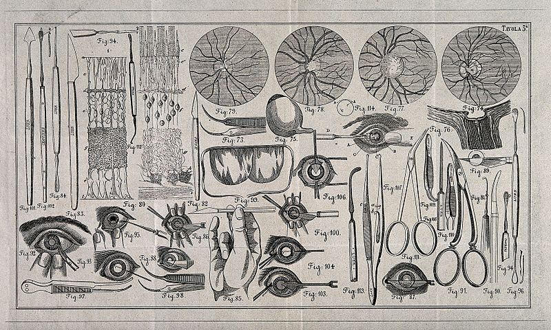 File:A sheet showing optical instruments, eye examinations and an Wellcome V0015917.jpg