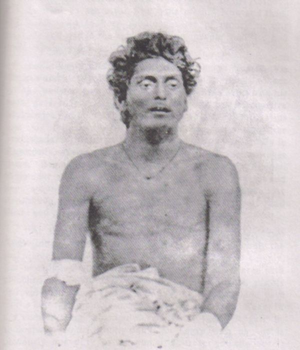 Bagha Jatin, wounded after his final battle on the banks of Burha Balang off Balasore.