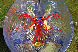 Circle of Willis (15426191433).jpg