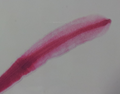 Thumbnail for File:Diphyllobothrium latum scolex x40.png