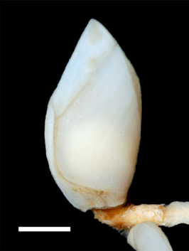 Glyptelasma hamatum