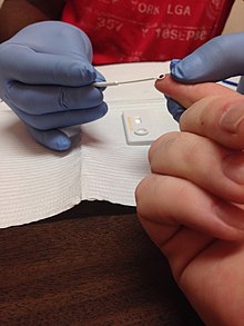 HIV Rapid Test being administered to a patient. HIV Rapid Test being administered.jpg