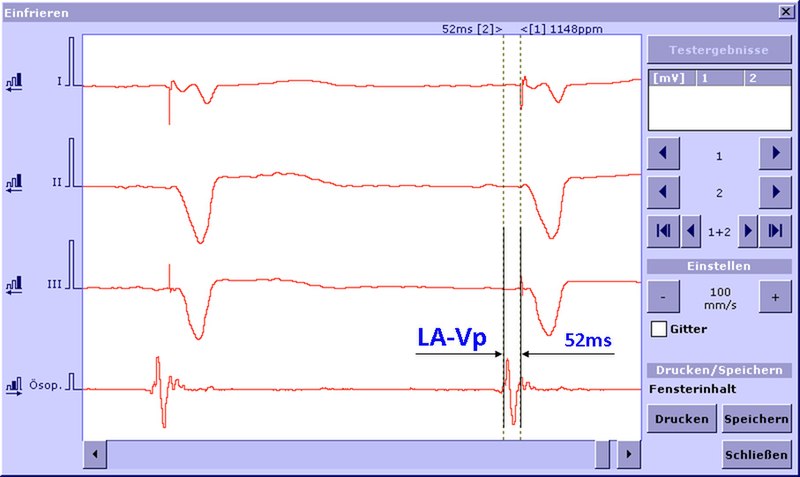 File:LA-Vp2.jpg