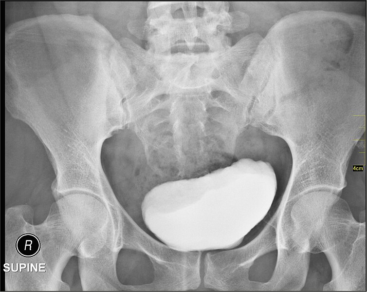 File:Medical X-Ray imaging AHO02 nevit.jpg