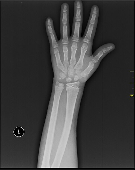 File:Medical X-Ray imaging VCA07 nevit.jpg