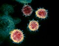 صورةٌ بالمجهر الإلكتروني النافذ لفيروس كورونا المرتبط بالمتلازمة التنفسية الحادة الشديدة النوع 2 (SARS-CoV-2) المعزول من مريضٍ في الولايات المتحدة