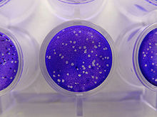 Plaques in cells caused herpes simplex virus. The cells have been fixed and stained blue. Plaque assay macro.jpg