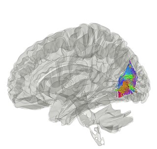 Vertical occipital fasciculus