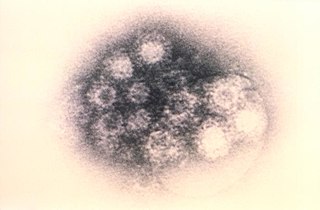 <span class="mw-page-title-main">Coxsackie A virus</span> Virus that causes digestive upset and sometimes heart damage