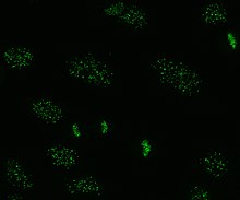 Immunofluorescence staining pattern of anti-centromere antibodies on HEp-20-10 cells CENTROMERE.jpg