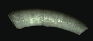 Caecum trachea 001.jpg