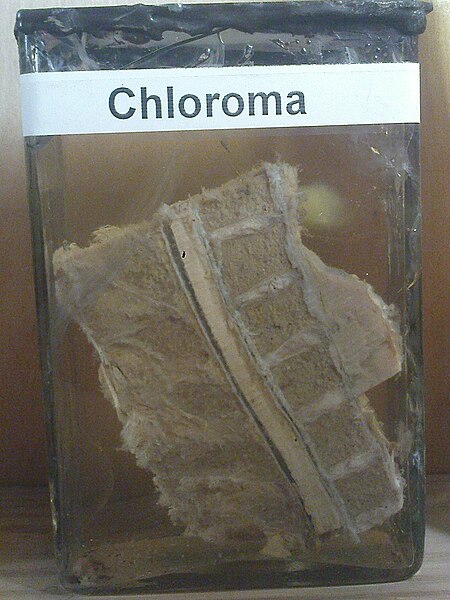 File:Chloroma CMUJ.jpg