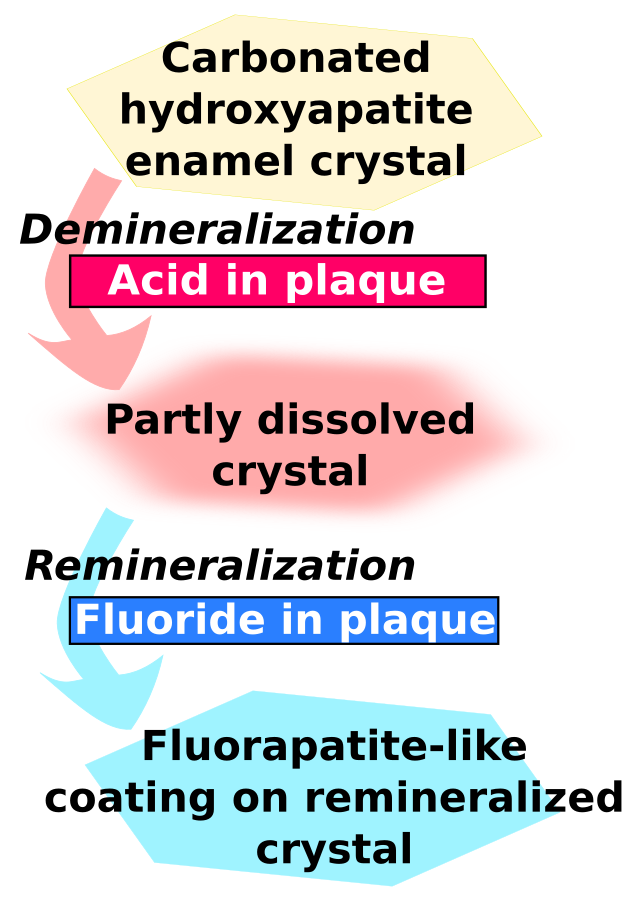 Carbonated hydroxyapatite enamel crystal is demineralised by acid in plaque and becomes partly dissolved crystal. This in turn is remineralised by fluoride in plaque to become a fluorapatite-like coating on remineralised crystal.