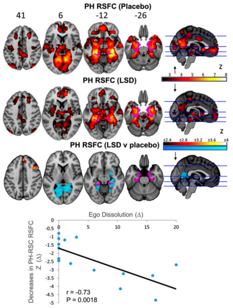 File:FMRI PH RSFC LSD.png