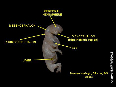 Cerebral hemispheres of a human embryo at 8 weeks.