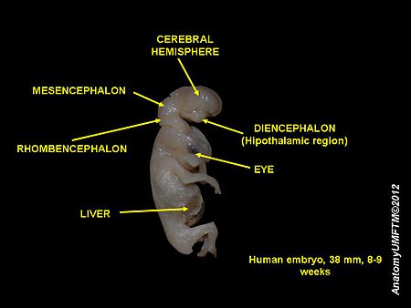 ไฟล์:Human_embryo_8_weeks_4.JPG