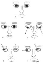 أعصاب قحفية