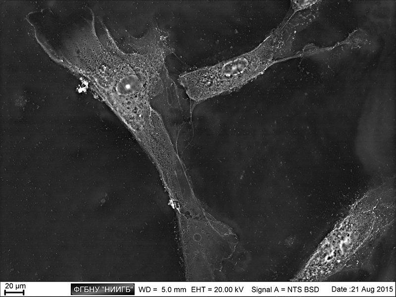 File:Limbal epithelium. Cells. SEM-BSE.jpg