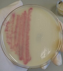 A selective and differential chromogenic medium for the qualitative direct detection of MRSA MRSA on a selective choromogenic media plate.jpg