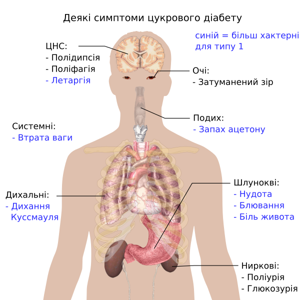 File:Main symptoms of diabete uk.svg