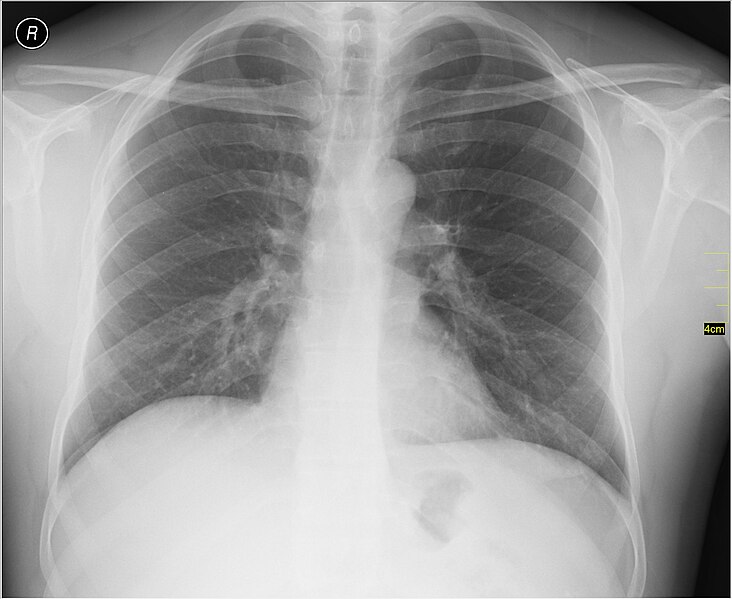 File:Medical X-Ray imaging POU06 nevit.jpg