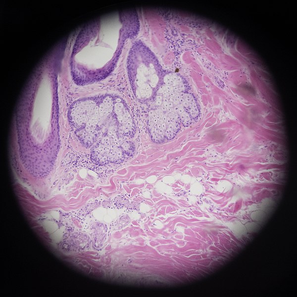 File:Scalp cross section (negro)2.jpg