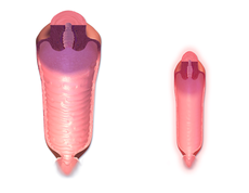 Vaginal Canal Normal vs. Menopause.png