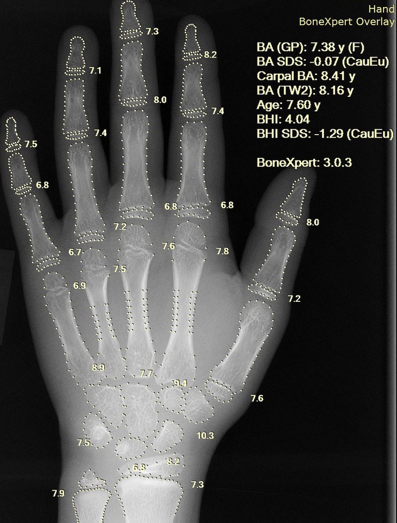 Hand x-ray in stained glass! : r/Radiology