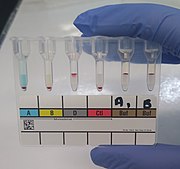 Blood typing by column agglutination method: type O positive Blood typing by gel card method (column agglutination or MTS gel) - type O positive.jpg