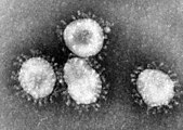 Coronaviruses viewed under an electron microscope.