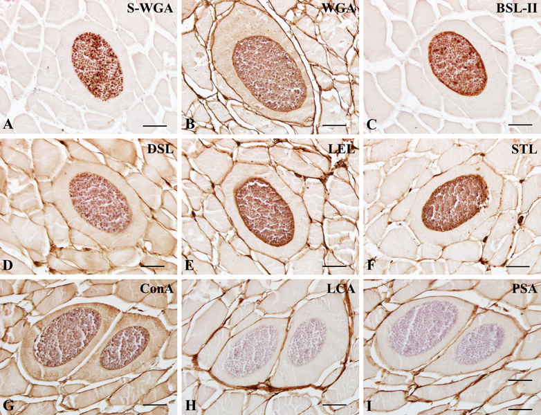 File:Parasite160010-fig2 - Lectins in Paralichthys olivaceus infected by Kudoa septempunctata - Lectin histochemistry.png