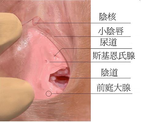 前庭大腺