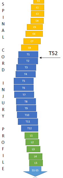 Visualization of where on the spinal cord an injury exists to be classified as T52. Athletic classes T52.png