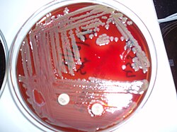 Elizabethkingia meningoseptica Blood agar plate.JPG