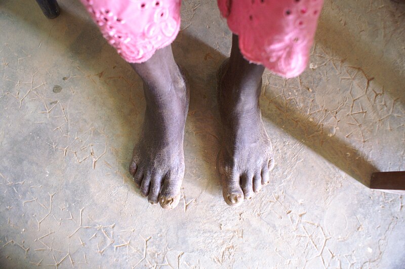File:Feet from Burkina Faso10.JPG