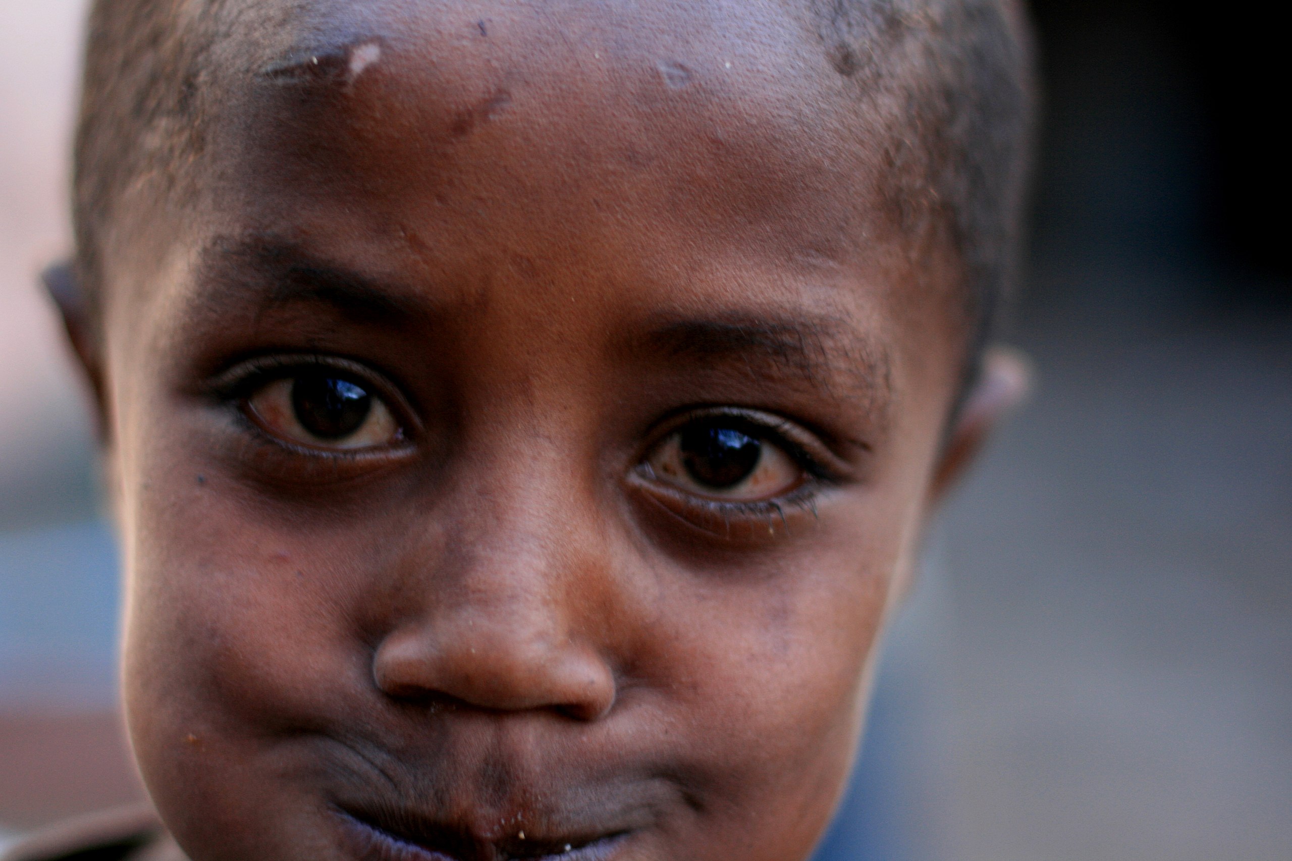 File:Funny face Amhara  - Wikimedia Commons