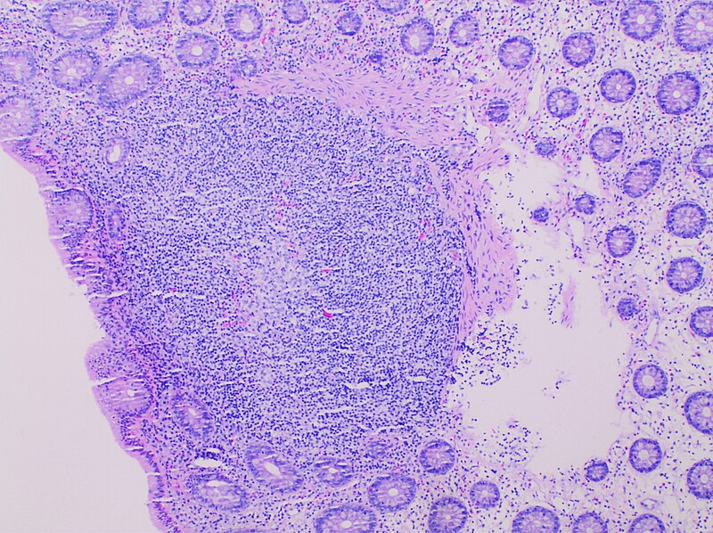 File:Histology of subepithelial lymphoid aggregate of the colon.jpg