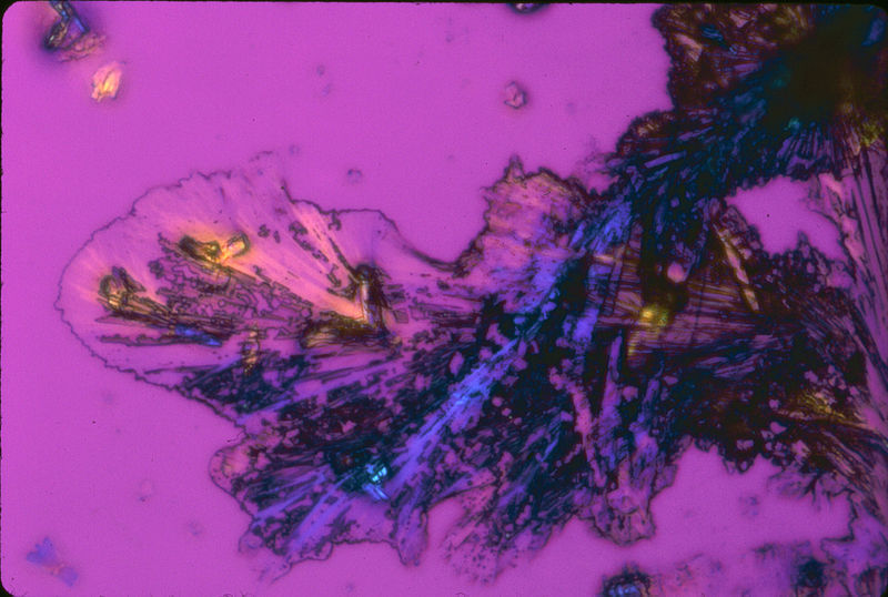 File:Nci-vol-8040-300 Cisplatin crystals.jpg