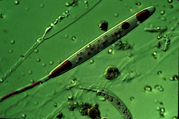 Nomarski micrograph of a ruthenium red-stained nematocyst from Aiptasia pallida, the pale anemone. The red dye stains the polyanionic venom proteins f