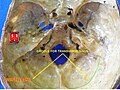 Occipital bone 4.jpg