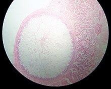 "Sarcocystis" cyst in a sheep oesophagus. The cyst is approximately 4 mm across.