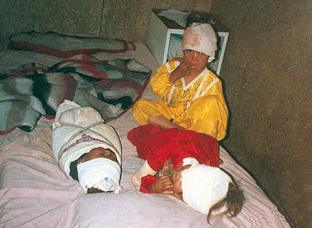 Children wounded by American airstrikes in Afghanistan's Surkh-Rōd District in 2001