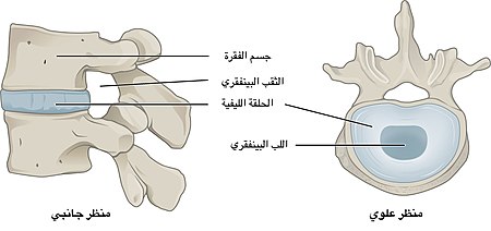 716 Intervertebral Disk - Arabic.jpg