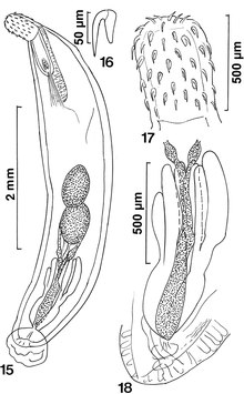 Acanthocephalus parallelcementglandatus.tif