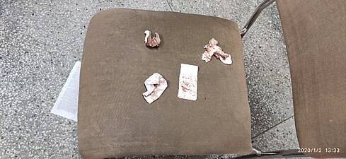 Attack on JMI's Library - Blood stains of victim students on chair 01.jpg