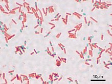 Bacillus subtilis Spore.jpg